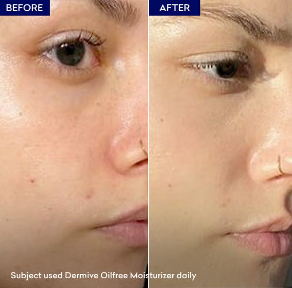 DermiVe Oil Free Moisturizer