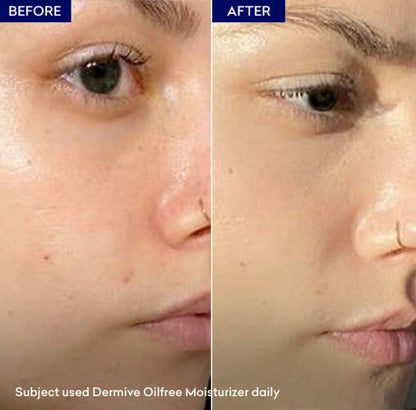 DermiVe Oil Free Moisturizer
